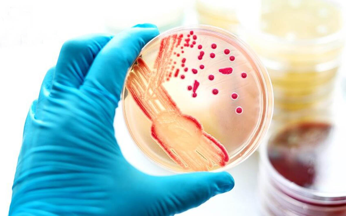 Việt Nam bổ sung đậu mùa khỉ vào danh mục bệnh truyền nhiễm nhóm B