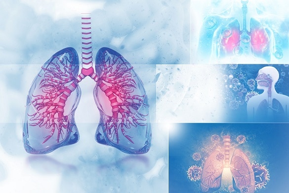 10% of children have bronchial asthma among the common respiratory diseases