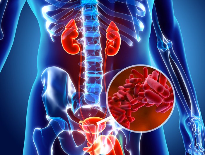 Cystitis and dangerous complications