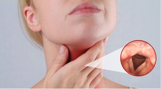 IS IT EFFECTIVE TO TREAT COUGH WITH EXPECTORANTS?