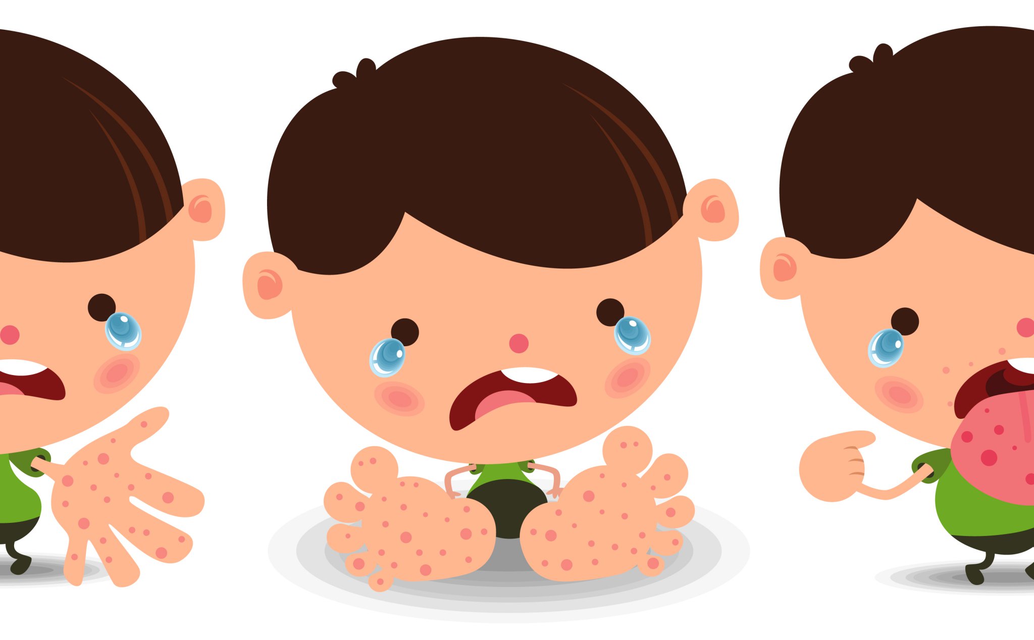 Prevention of hand, foot and mouth disease for individuals and communities