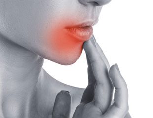 Safe and effective treatment of mouth ulcers?