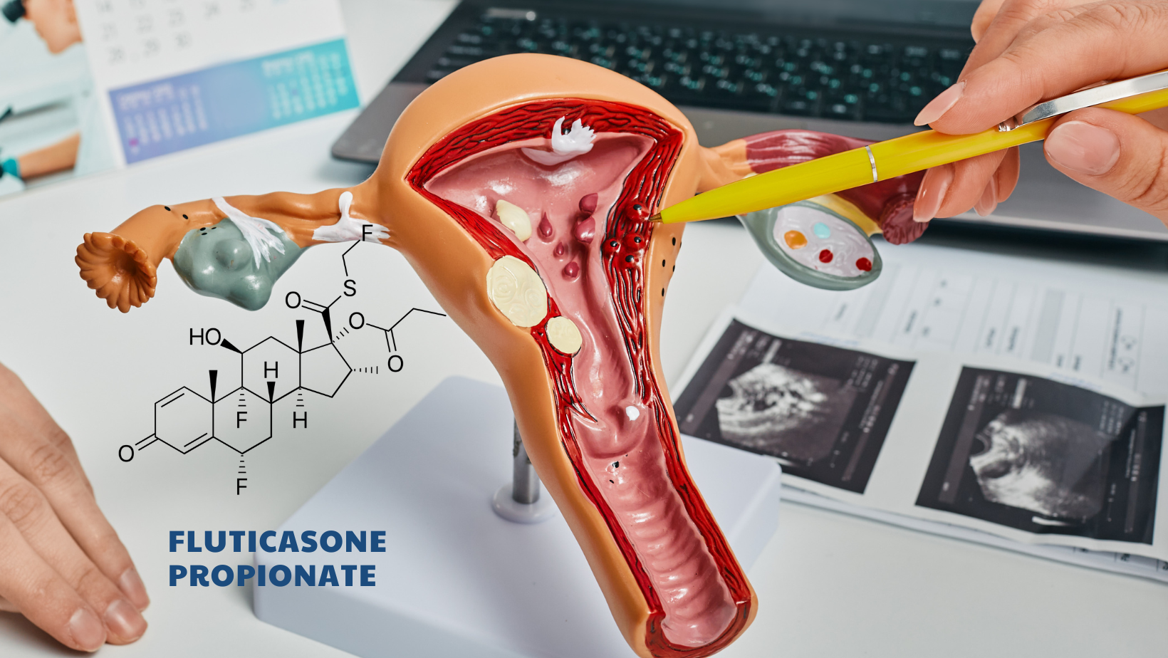 Fluticasone - Effects in treating nasal polyps