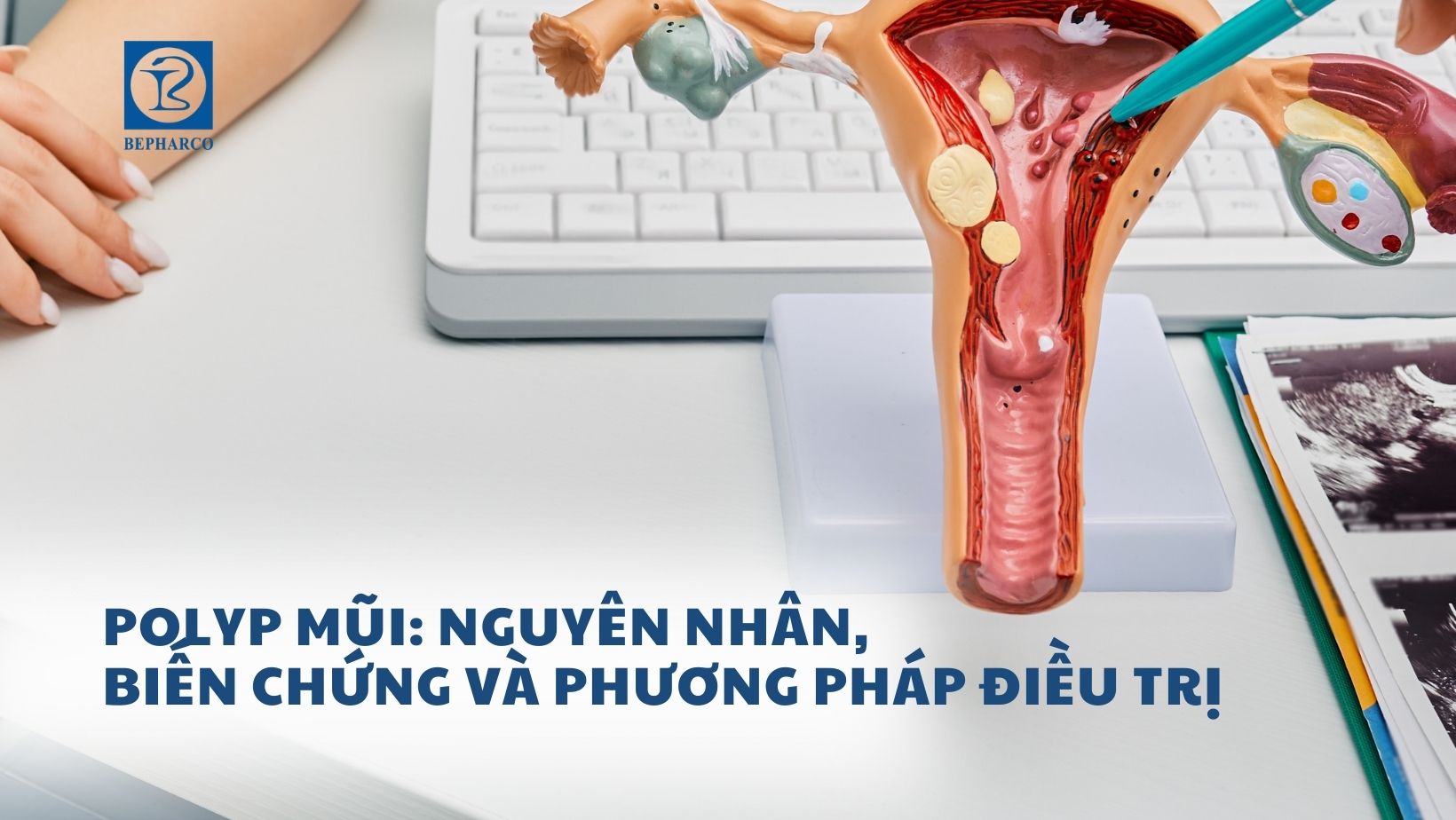 Polyp mũi: Nguyên nhân, biến chứng và phương pháp điều trị