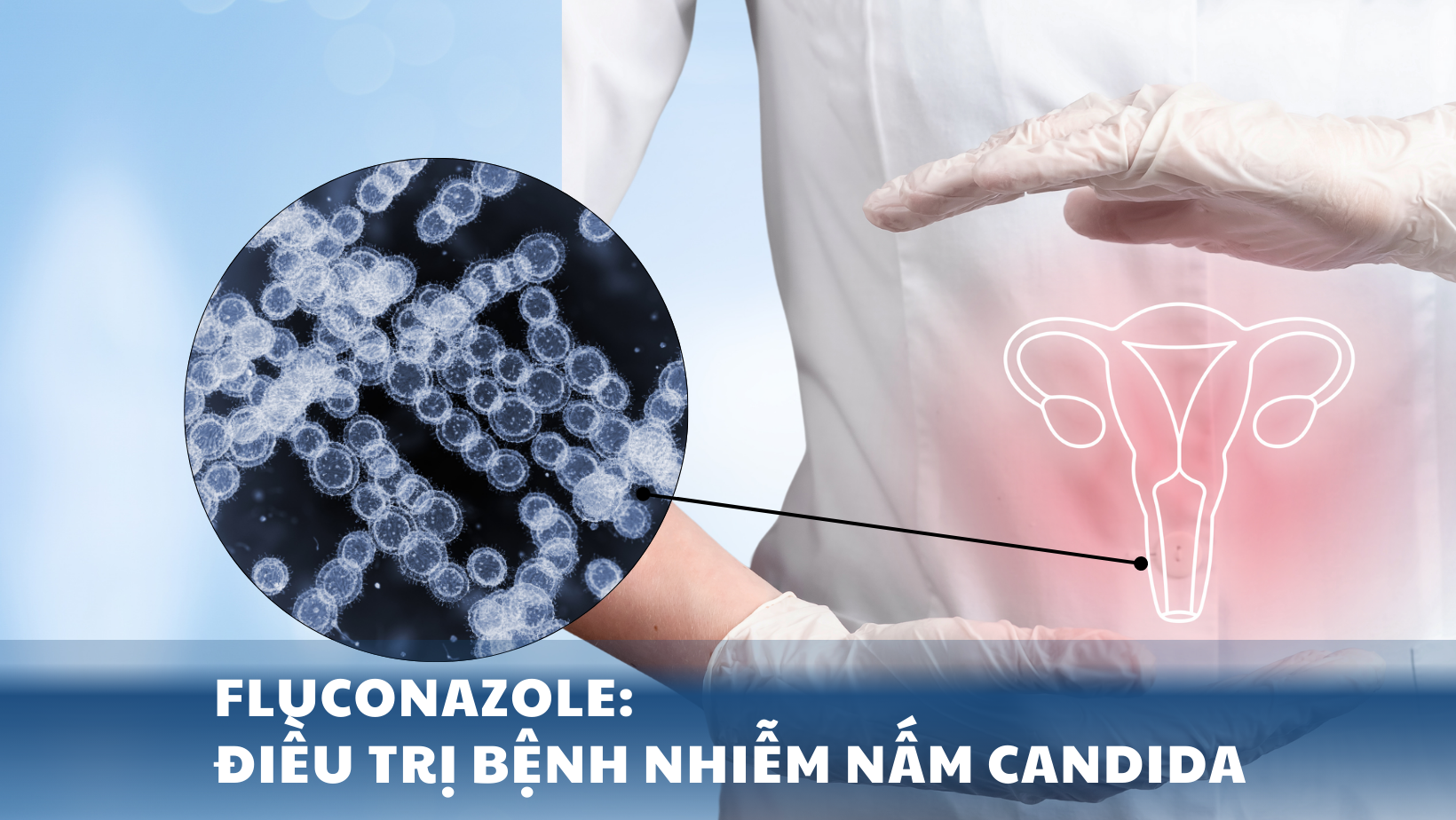 Fluconazole: Điều trị bệnh nhiễm nấm Candida